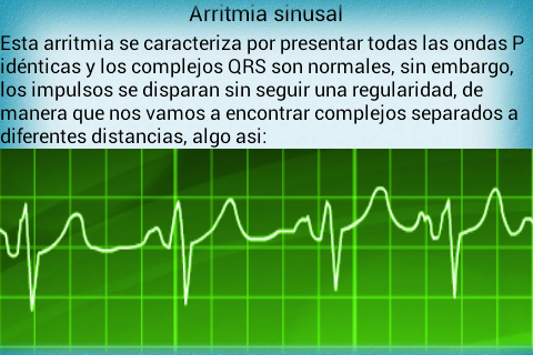 【免費醫療App】Electrocardiograma PRO-APP點子