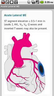 Critical Care ACLS Guide(圖4)-速報App