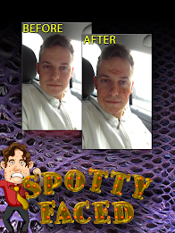 SpottyFaced Freckle Geek Booth poster 2