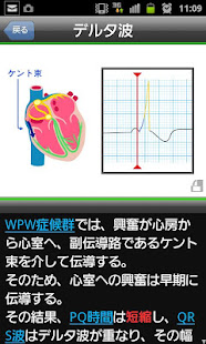 らくらく心電図トレーニング（英語モード付き）(圖3)-速報App