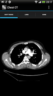 RadRevision: Anatomy on CT(圖4)-速報App