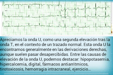 Electrocardiograma PRO poster 21