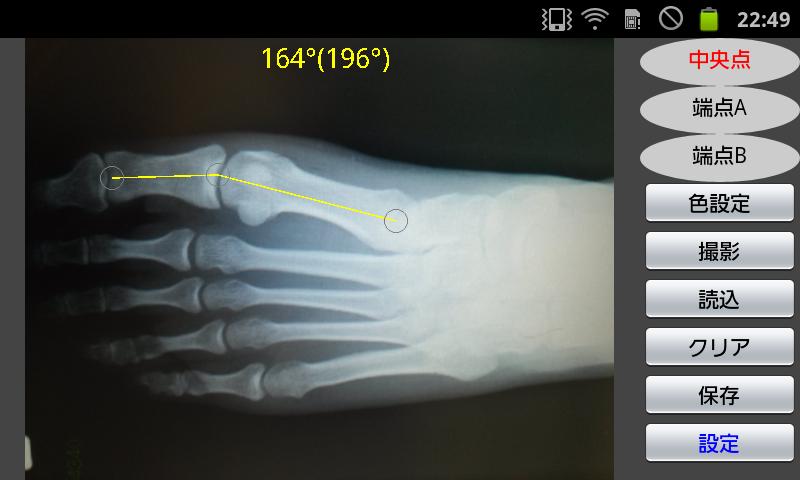 角度計 - Goniometer Screen 2