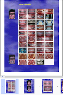 ACP Board Study Guide Screenshots 5