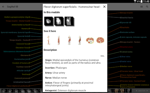 IMAIOS e-Anatomy