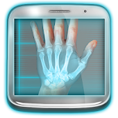 X-Ray Scanner: Augmented Prank