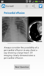 免費下載醫療APP|Chest X-Ray Training app開箱文|APP開箱王