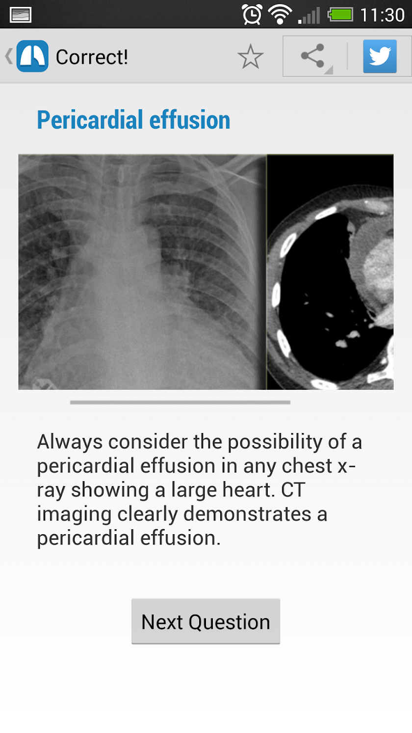Chest X-Ray Training Screen 3
