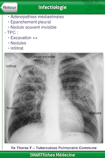 How to download SMARTfiches Infectiologie 1.01 apk for bluestacks
