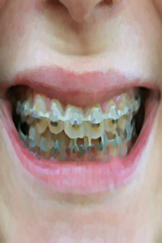 ดัดฟัน Dental Brace Booth