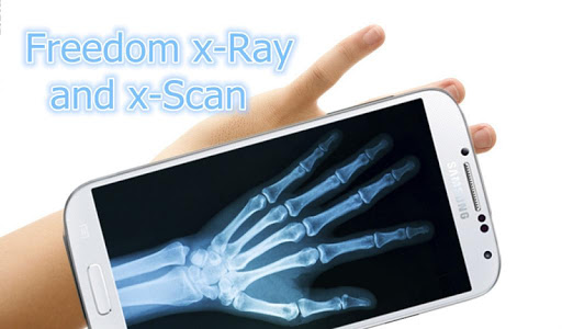 X-Ray Scanner for free