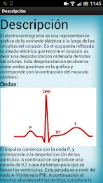 Electrocardiograma poster 1