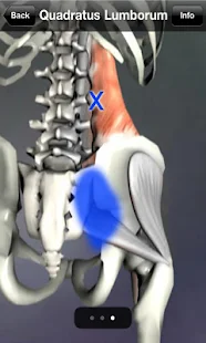 Muscle Trigger Point Anatomy - screenshot thumbnail