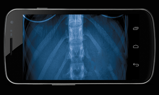 Body Xray- Prank Screenshots 4