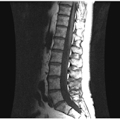 Preguntas de Traumatologia
