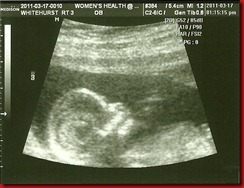 Baby 3 @ 13 weeks (profile)