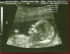 Baby 2 @ 13 weeks (profile)