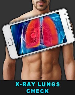 X光檢查肺部