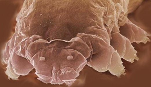 Face of a Follicle Mite
