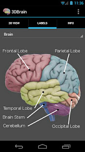 3D Brain(圖3)-速報App