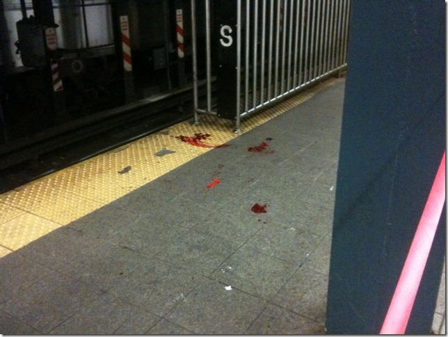 18 year old student struck by train at Union Square, 14th street. 18 year old student struck by train at Union Square, 14th street.