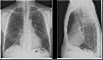 Radiologi1