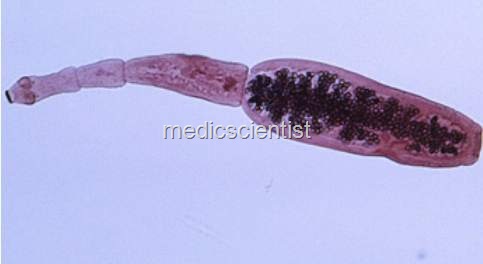 ECHINOCOCCOSIS%20OR%20HYDATID%20DISEASE%20jvg%5B2%5D.jpg