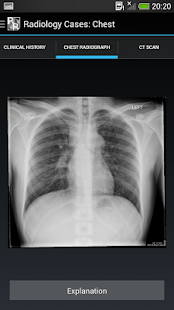 Radiology Cases: Chest(圖4)-速報App