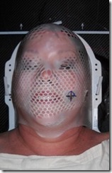 radiation mask 2