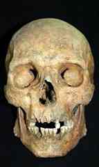 The skull of a black man found in Suffolk