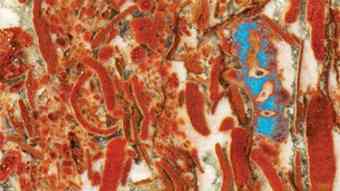 Limestone rock in Australia contained fossils (shown in blue) that may represent Earth's earliest animal life. A serial grinding process created nearly 500 such images that scientists stacked and autotraced to create a 3-D model.