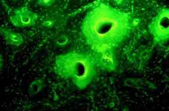 Green florescence in Nubian skeletons indicating tetracycline-labeled bone.