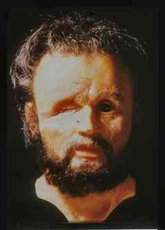 Facial reconstruction of the mystery skeleton done by medical illustrator Richard Neave, purporting to show Philip II with his famous eye wound. 