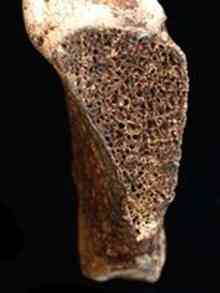 This child's breastbone was likely sliced by a metal blade. Photograph courtesy Sam Scholes.