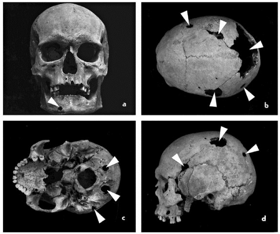 [28CANCER2popup5.jpg]