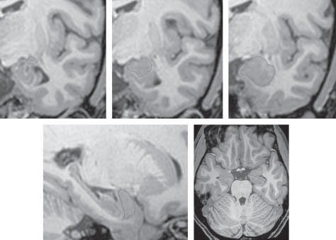 [amygdala-brain-scans[4].jpg]