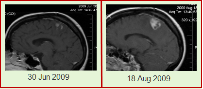 [MRI_Compare[4].png]