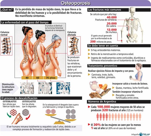 89995_osteoporosis