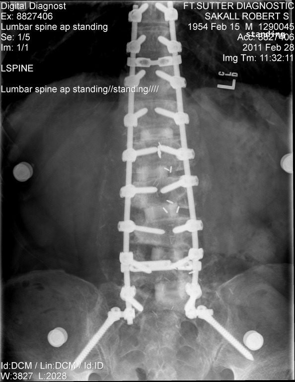 [screwedback[7].jpg]