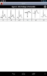Tarascon Emergency Medicine Screenshots 14