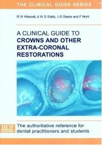 [Crowns and other extra-coronal restoration[6].jpg]