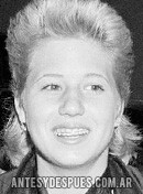 Chaz Bono, 1983