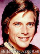 Dirk Benedict, 1980