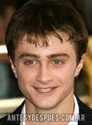 Daniel Radcliffe,  