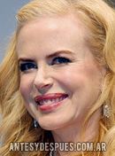 Nicole  Kidman,  