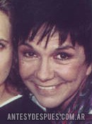 El Antes y Despues de Virginia Lago | Biografia, Fotos y Familia