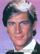 Simon MacCorkindale, 1983