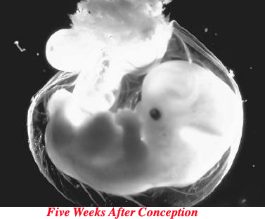 [fetus-at-five-weeks[3].gif]