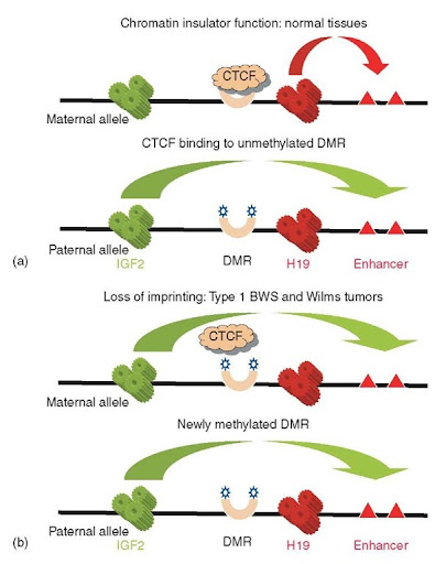 Loss of IGFImprinting: A Potential Marker of Colorectal Cancer