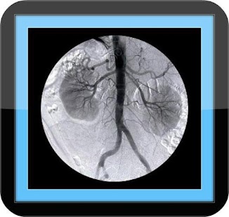 Kidney Failure - Signs Treat